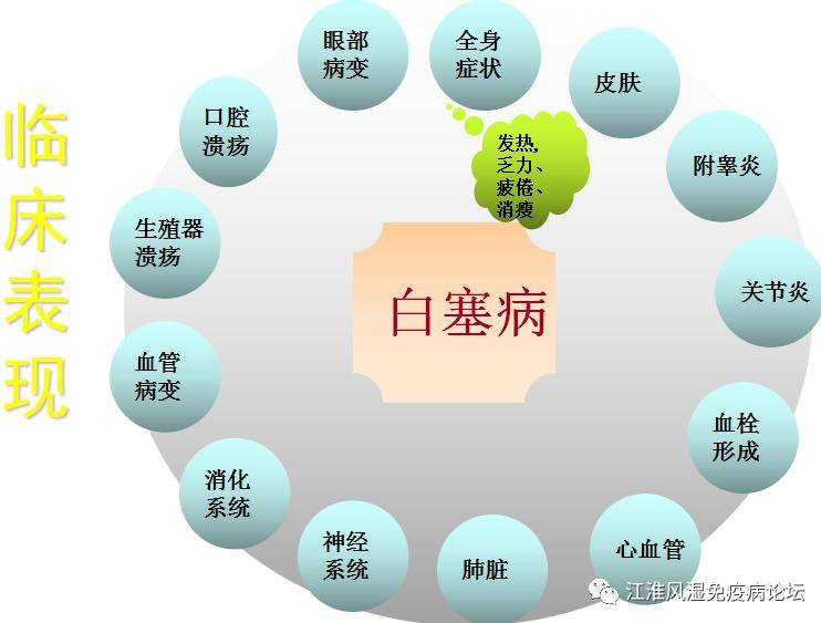 白塞最新研究進(jìn)展與治療方法